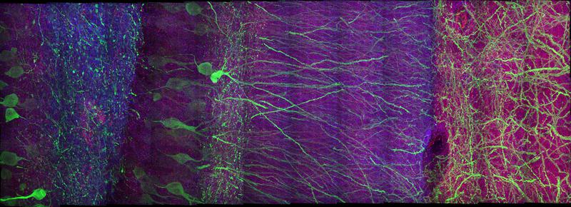 Expansion Microscopy