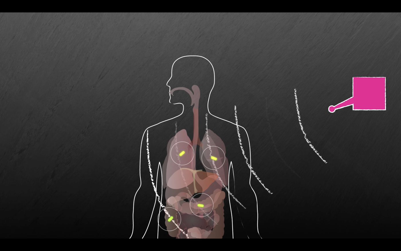 Wireless system can power devices inside the body — MIT Media Lab