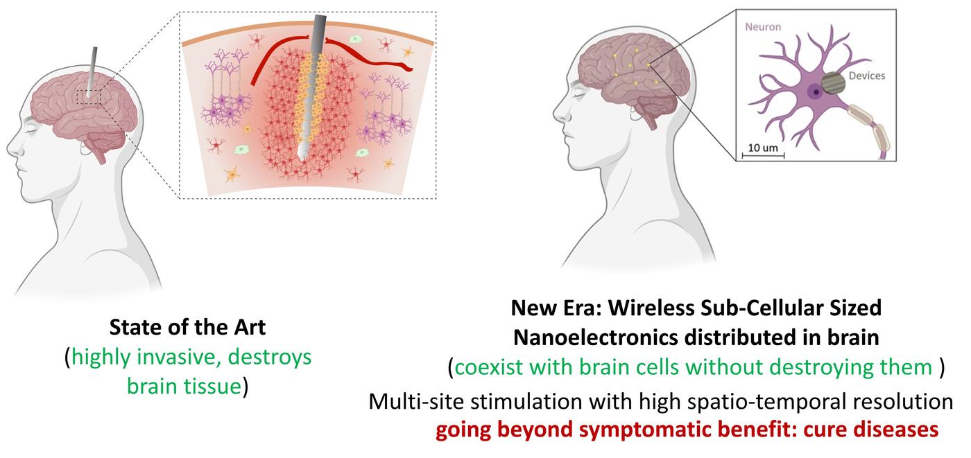 Overview ‹ Nano-Implants for Wireless Brain Interfacing — MIT Media Lab